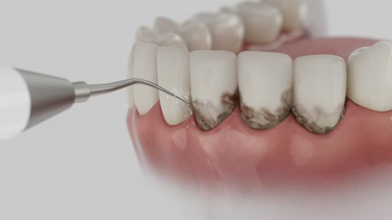 Reliable Dental Implants contractor in Whitehouse, TX by Smile Center Dentistry